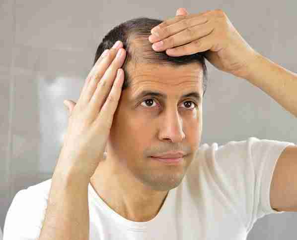 man looking in the mirror at his balding hair
