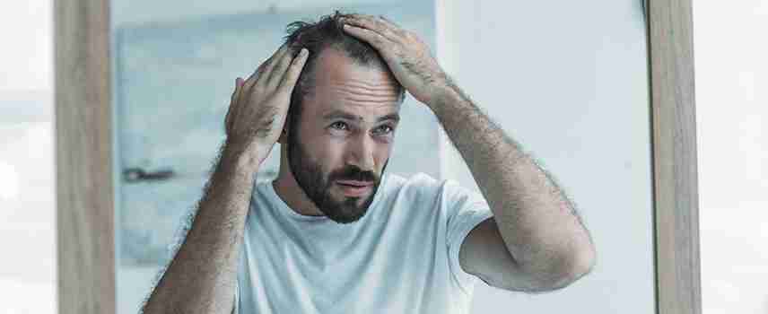 man dealing with hair loss